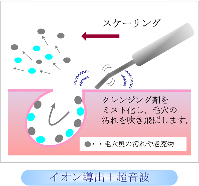 イオン導出 + 超音波