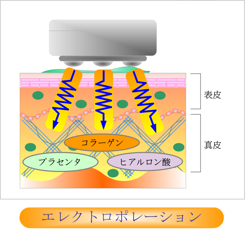 エレクトロポレーション